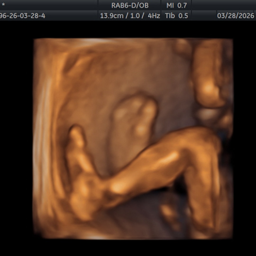 Photo shared by Sierra for their Babylist baby registry.