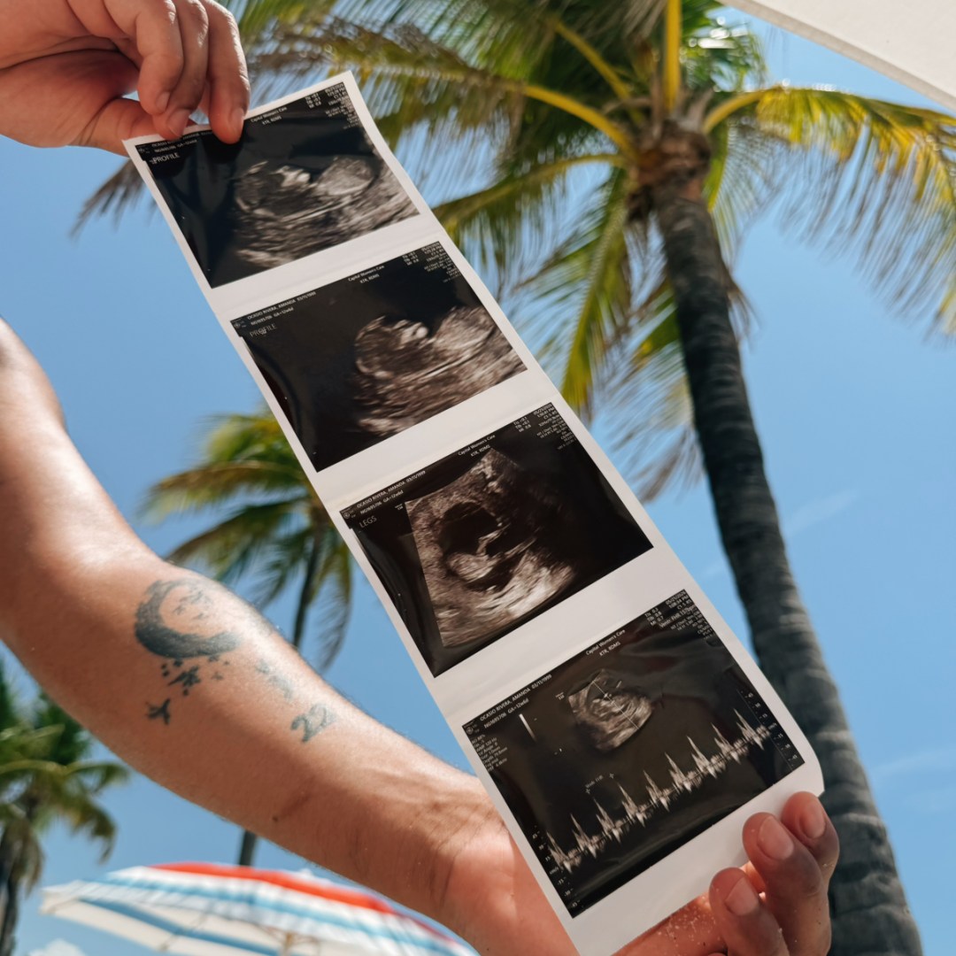 Photo shared by Bryan for their Babylist baby registry.