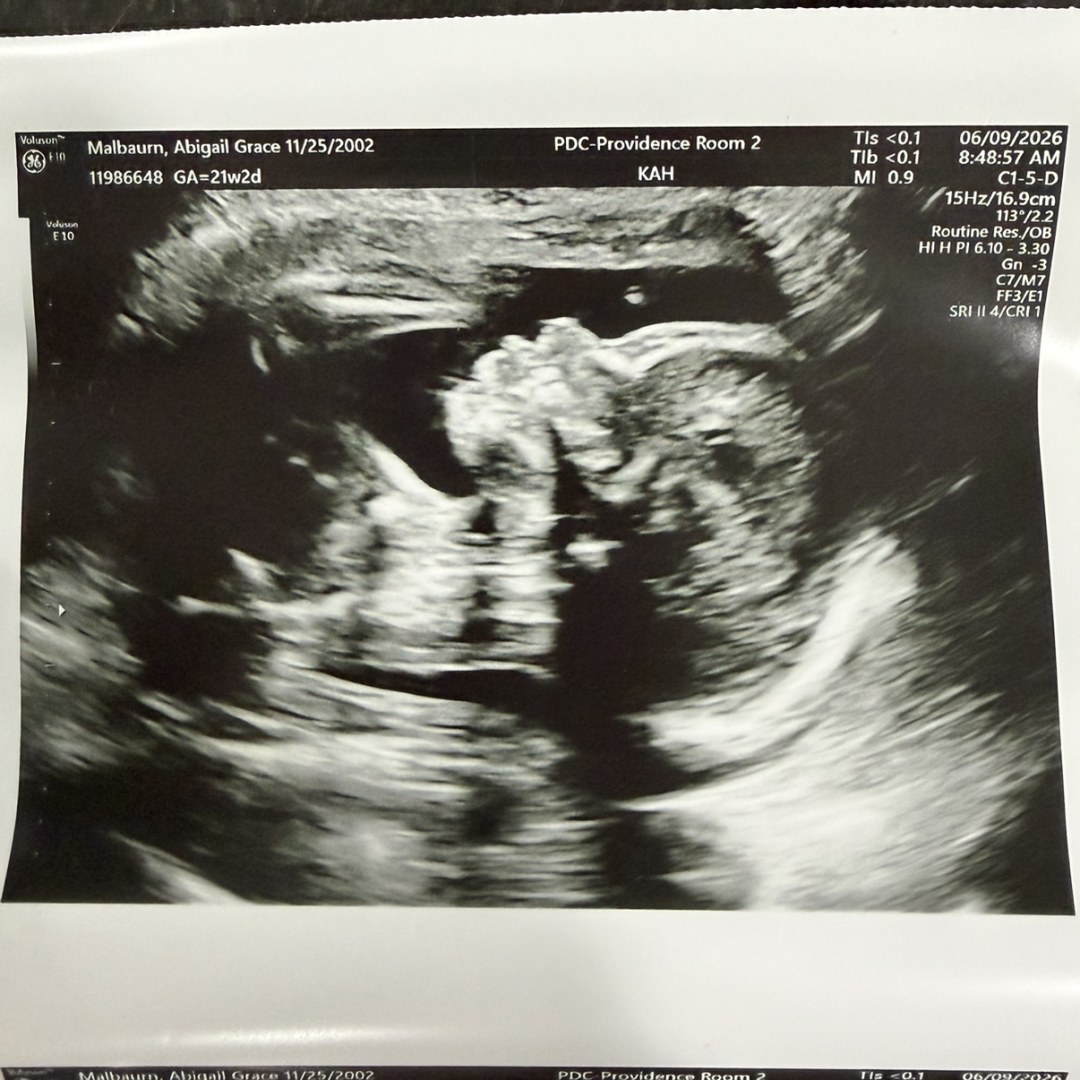 Photo shared by Abby for their Babylist baby registry.