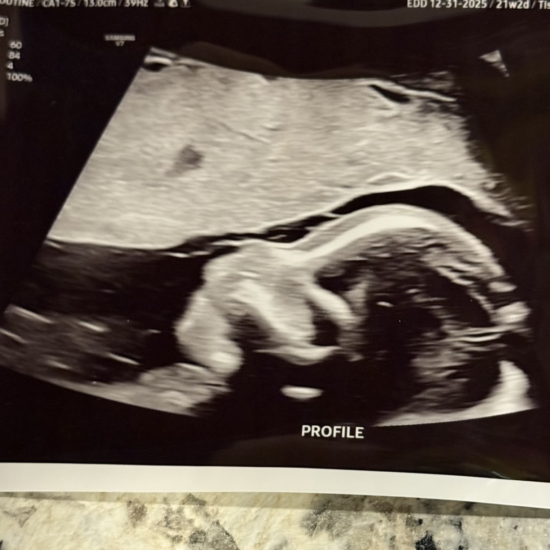 Photo shared by Calli for their Babylist baby registry.