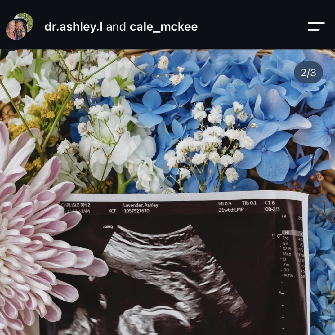 Photo shared by Ashley for their Babylist baby registry.