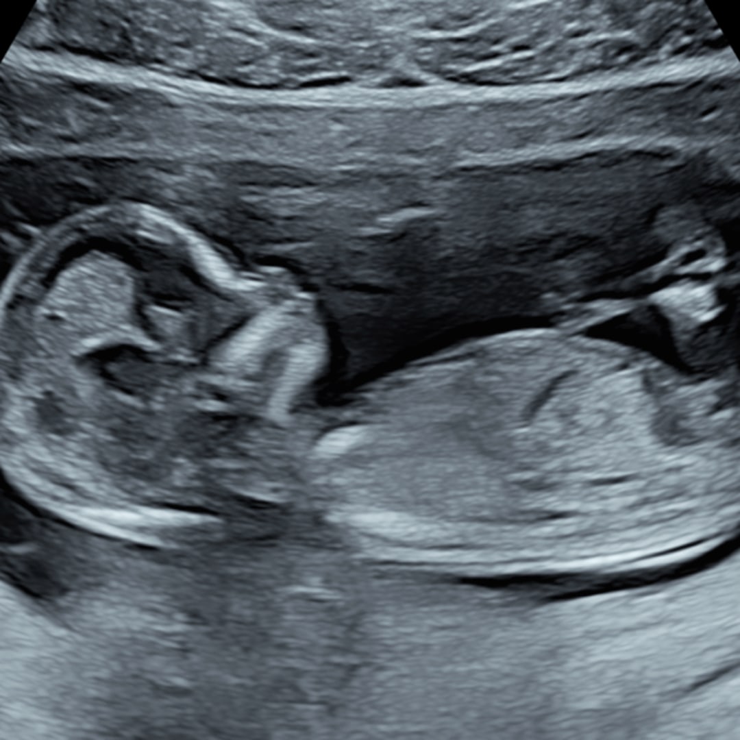 Photo shared by Emily for their Babylist baby registry.