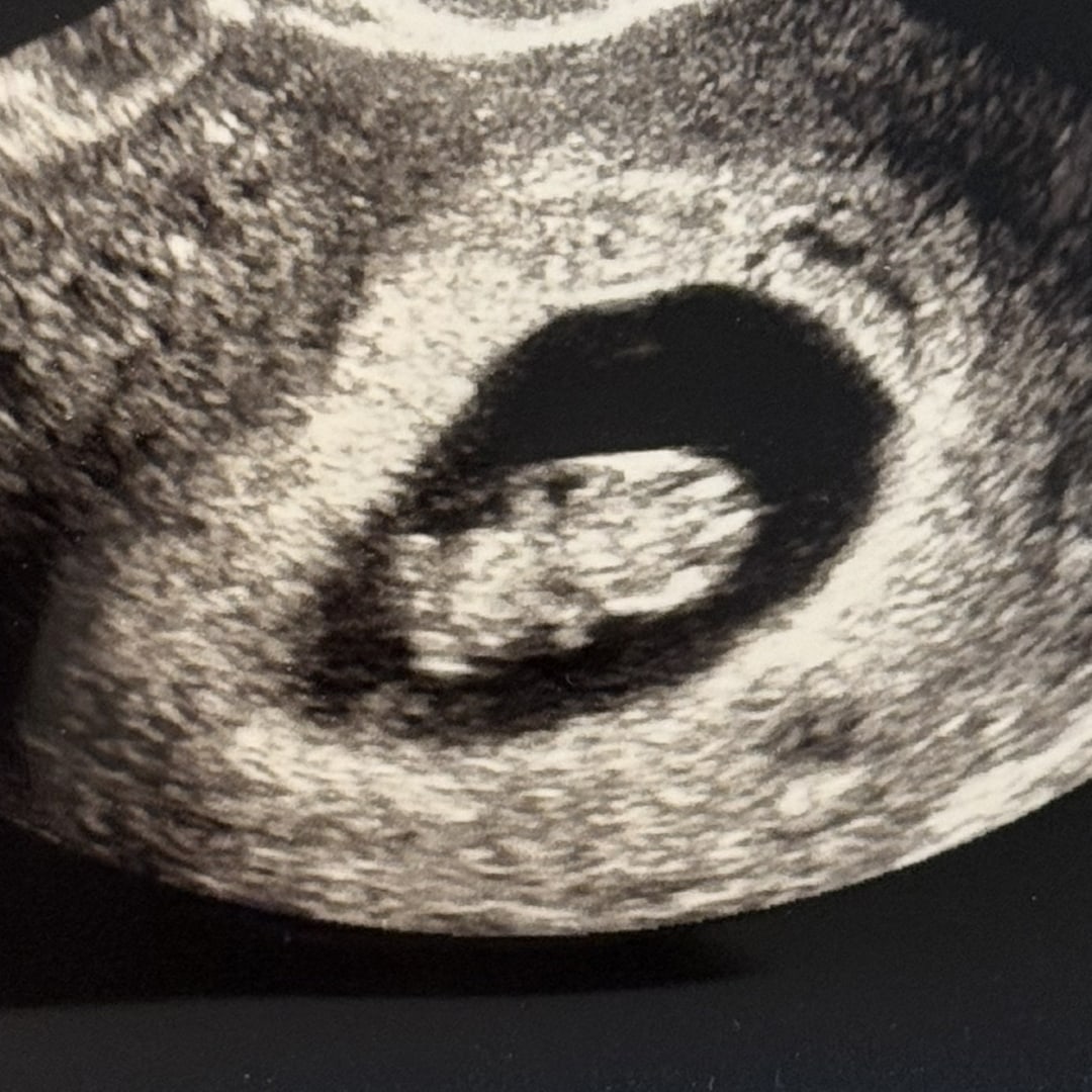 Photo shared by Maggie for their Babylist baby registry.