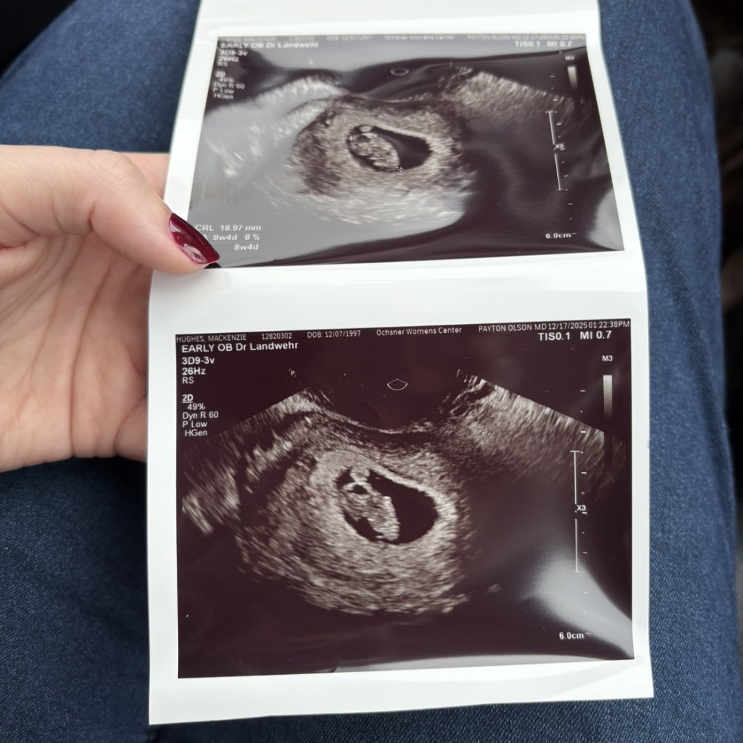 Photo shared by Mackenzie for their Babylist baby registry.