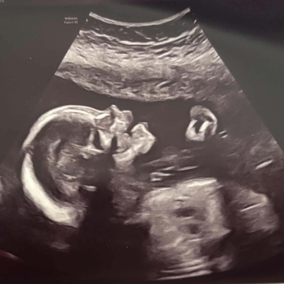 Photo shared by Neely for their Babylist baby registry.