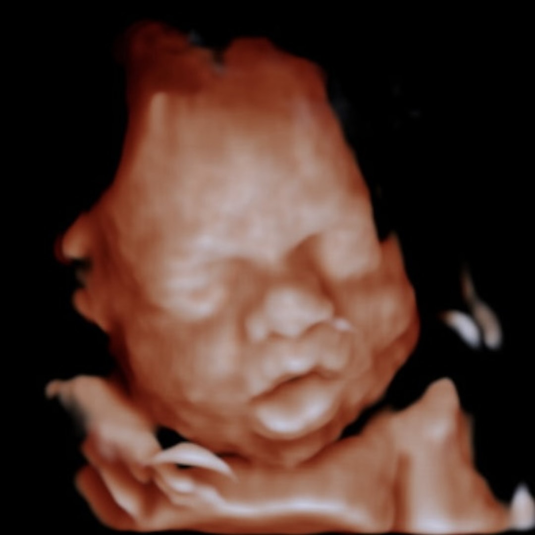 Photo shared by McKenna for their Babylist baby registry.