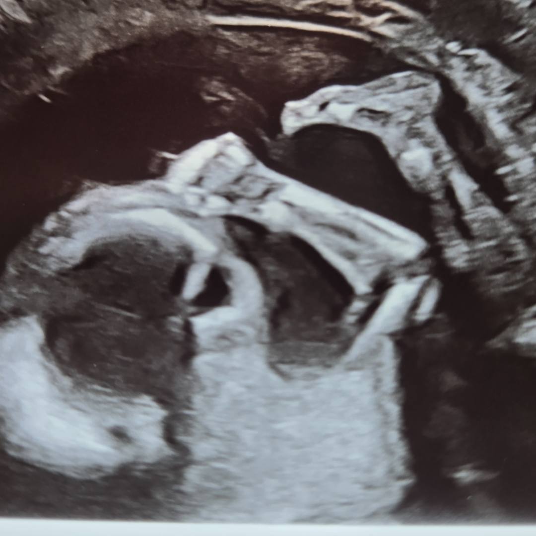 Photo shared by Adrienne for their Babylist baby registry.
