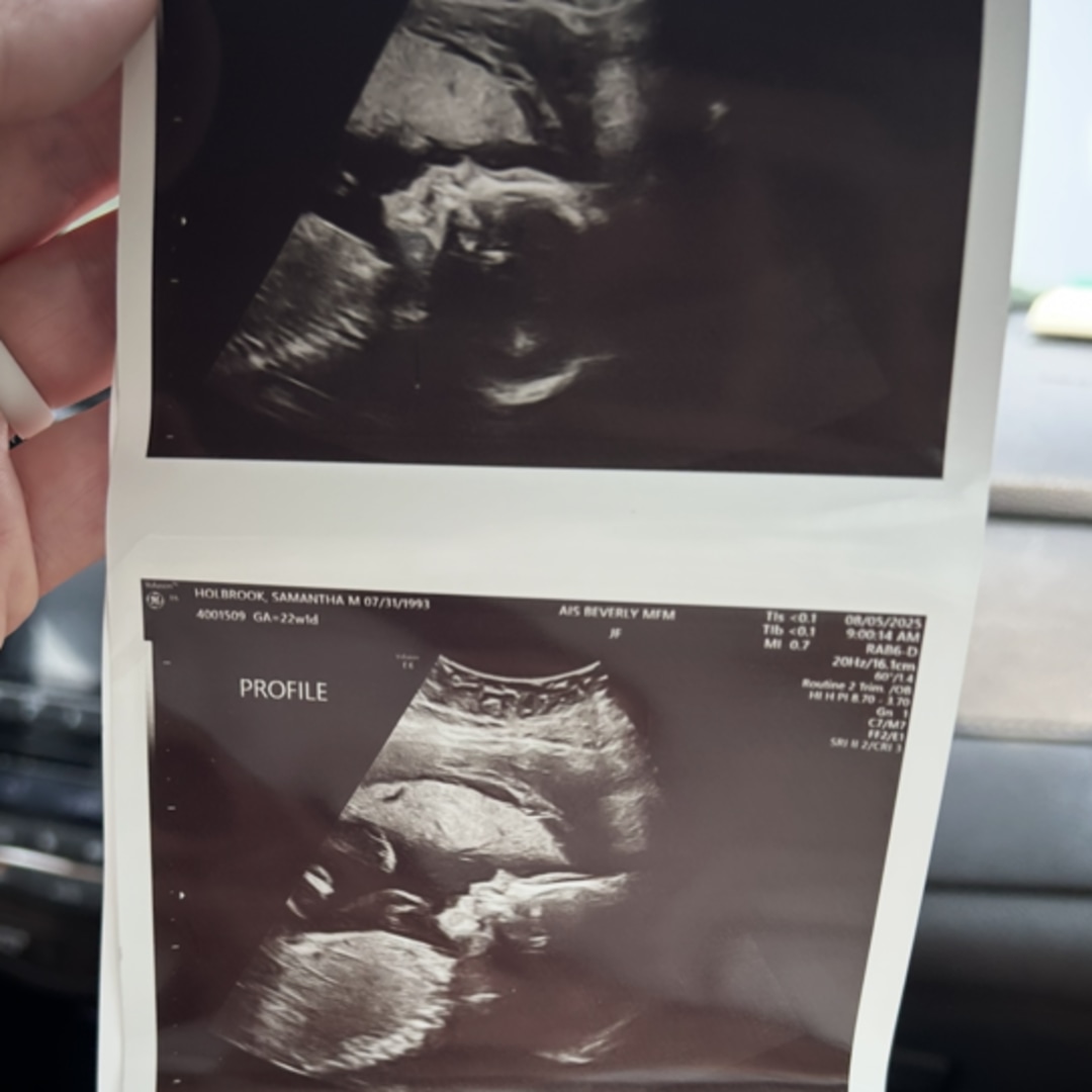 Photo shared by Samantha for their Babylist baby registry.