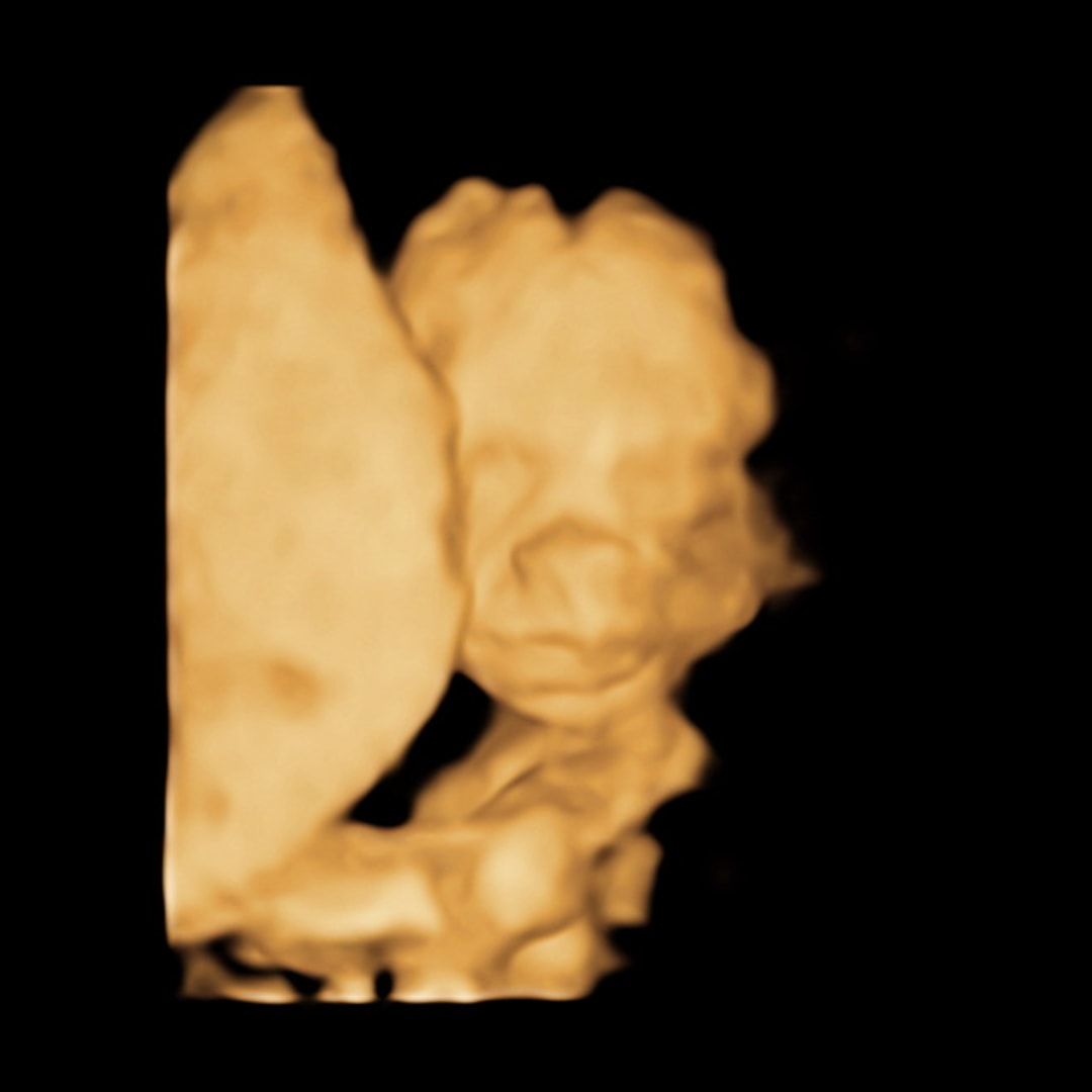 Photo shared by Evyr for their Babylist baby registry.