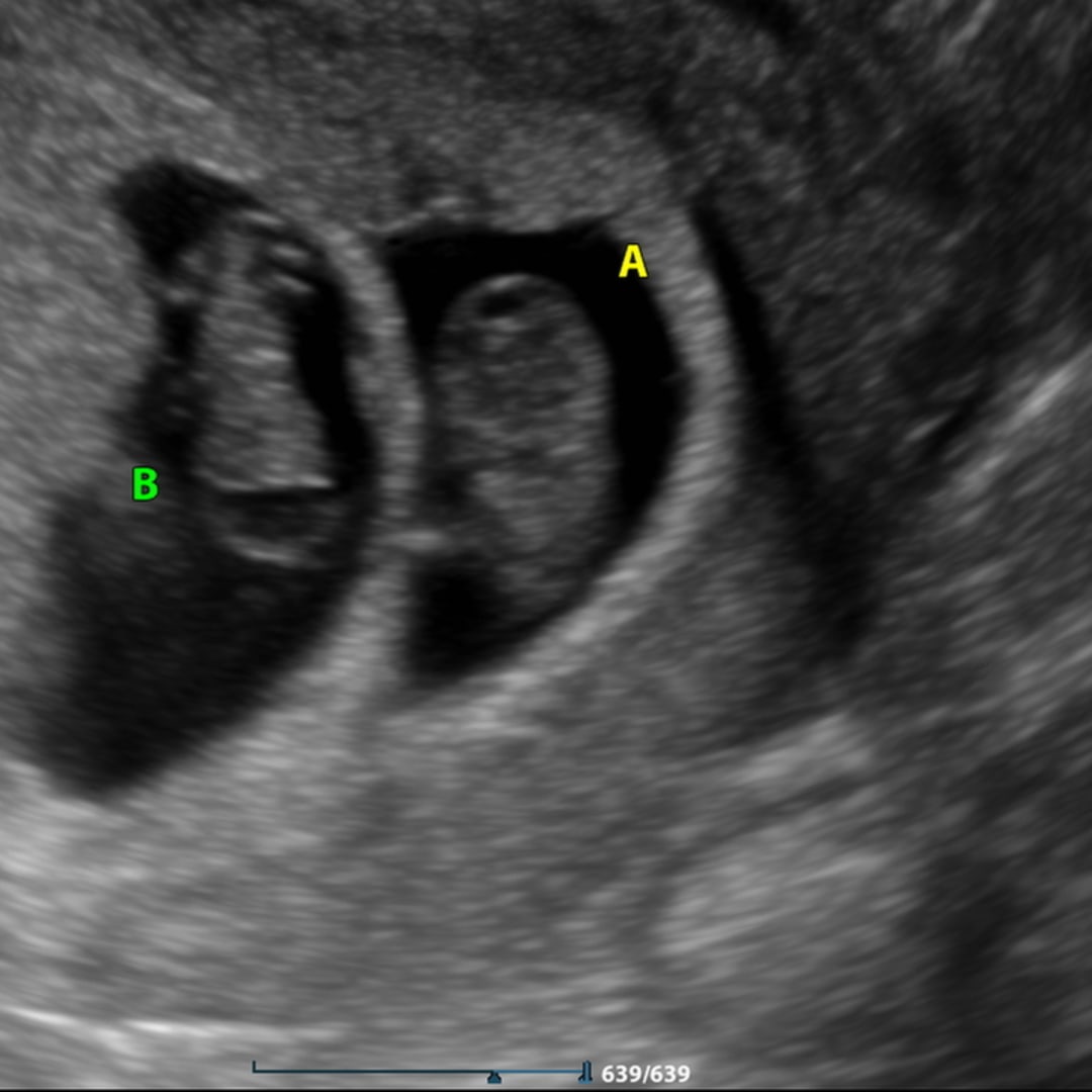 Photo shared by Ashelyn for their Babylist baby registry.