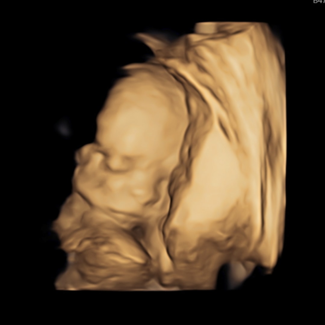 Photo shared by Brianna for their Babylist baby registry.