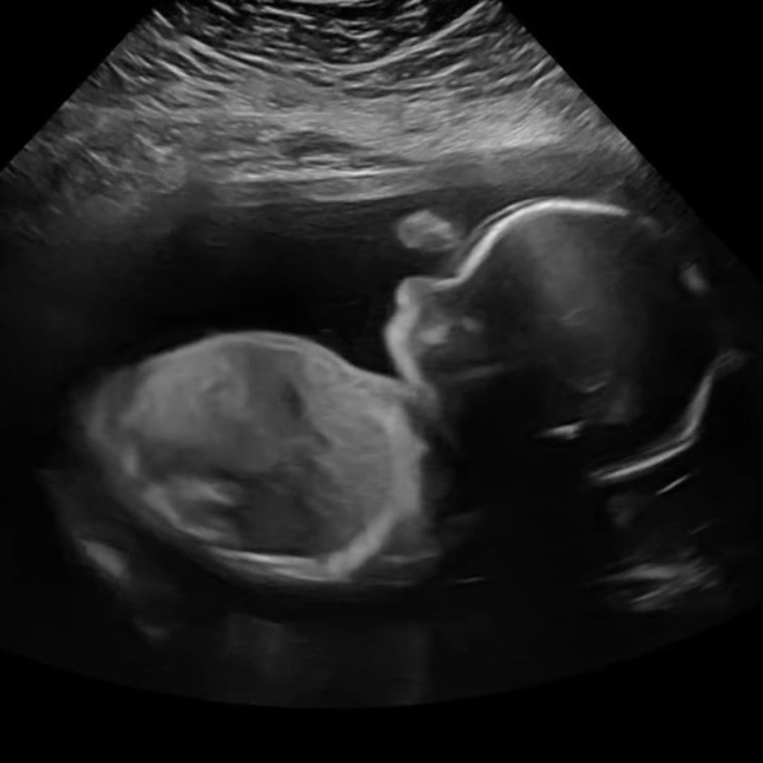 Photo shared by Jessica for their Babylist baby registry.