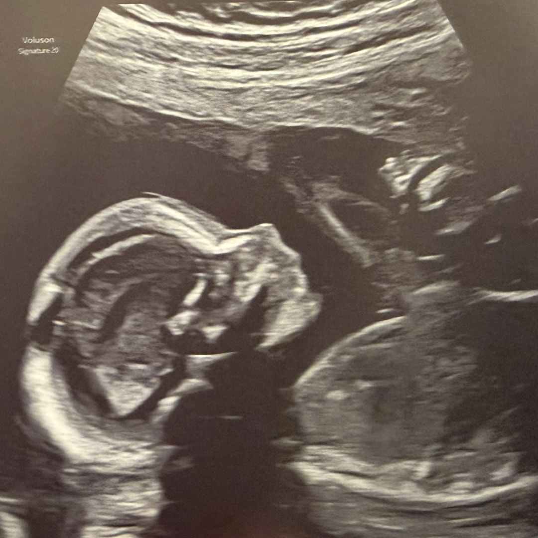 Photo shared by Hope for their Babylist baby registry.
