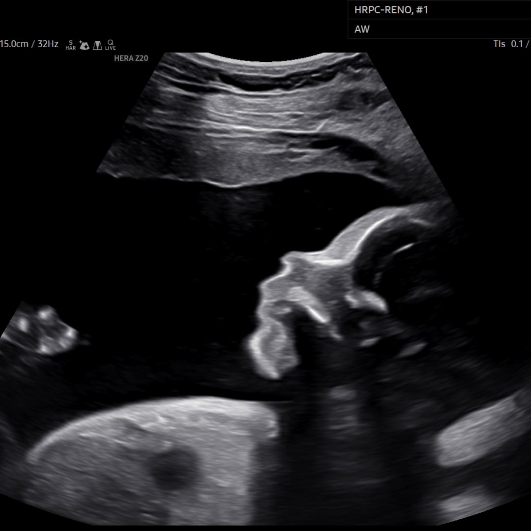Photo shared by Hannah for their Babylist baby registry.