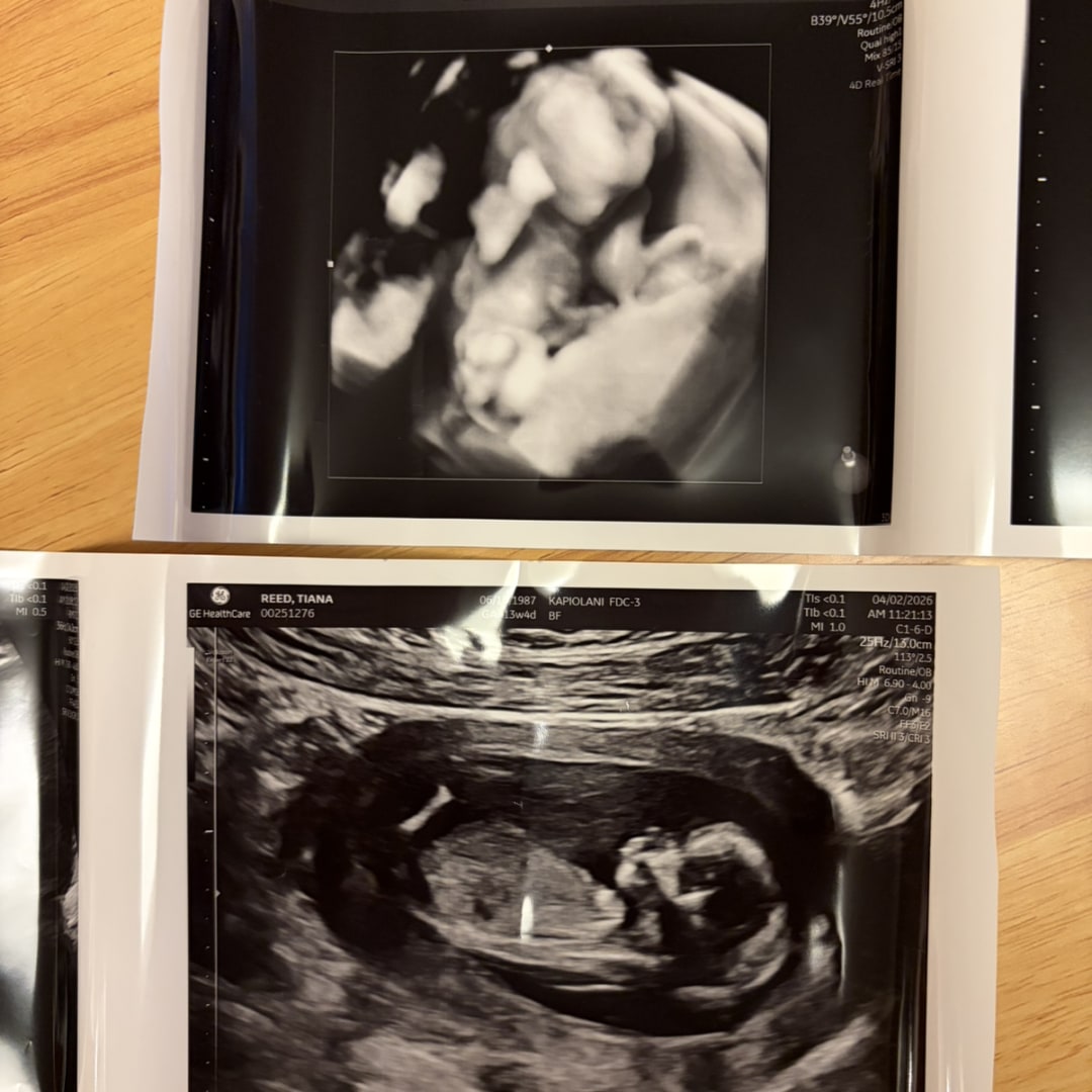 Photo shared by Tiana for their Babylist baby registry.