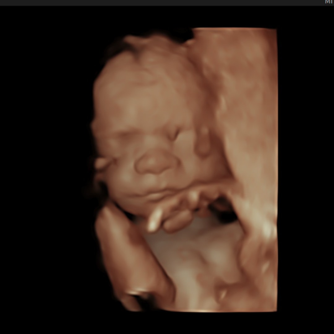 Photo shared by Krista for their Babylist baby registry.