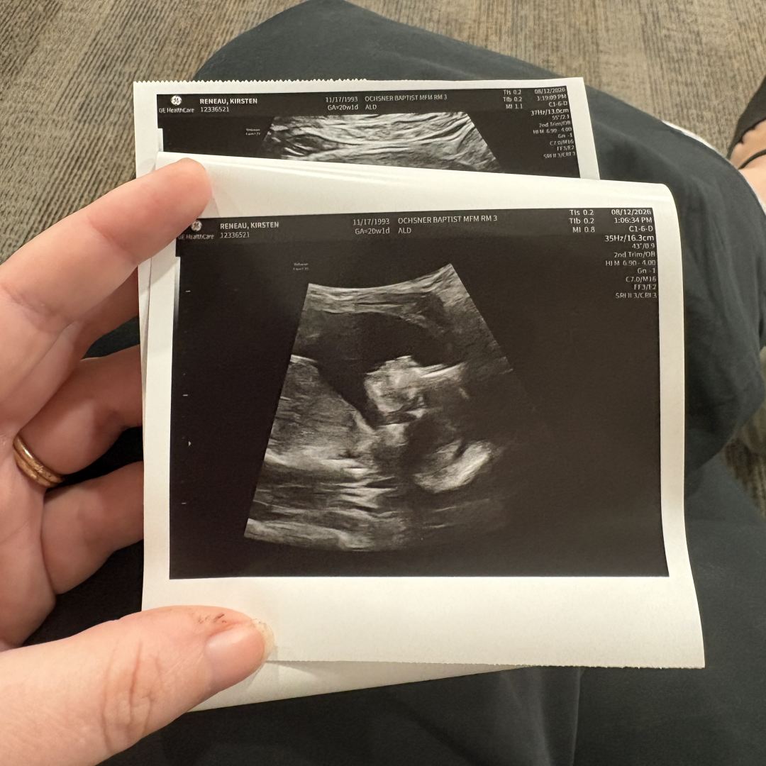 Photo shared by Kirsten for their Babylist baby registry.