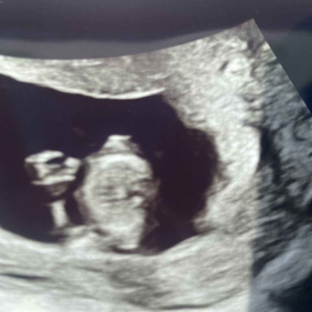 Photo shared by Kenesha for their Babylist baby registry.