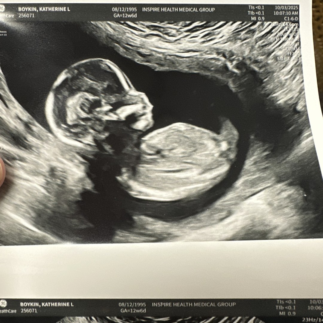 Photo shared by Katherine for their Babylist baby registry.