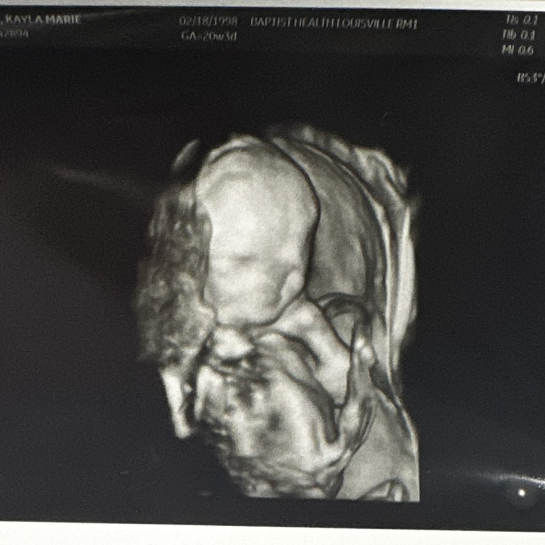 Photo shared by Kayla for their Babylist baby registry.