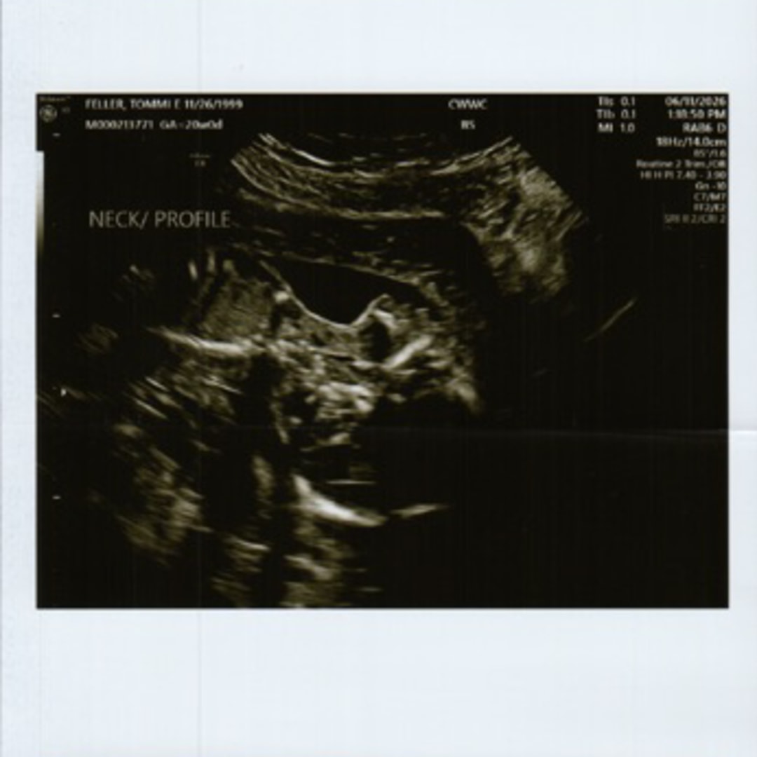 Photo shared by Tommi for their Babylist baby registry.