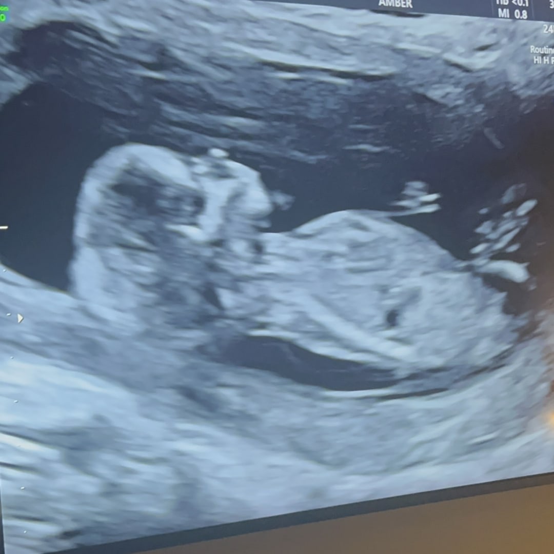 Photo shared by Cameren for their Babylist baby registry.