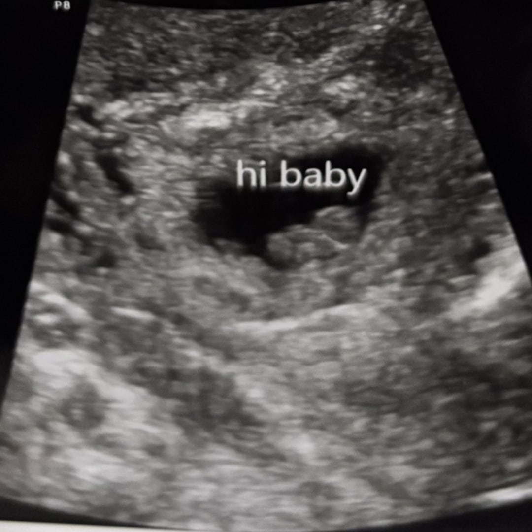 Photo shared by Anjala for their Babylist baby registry.