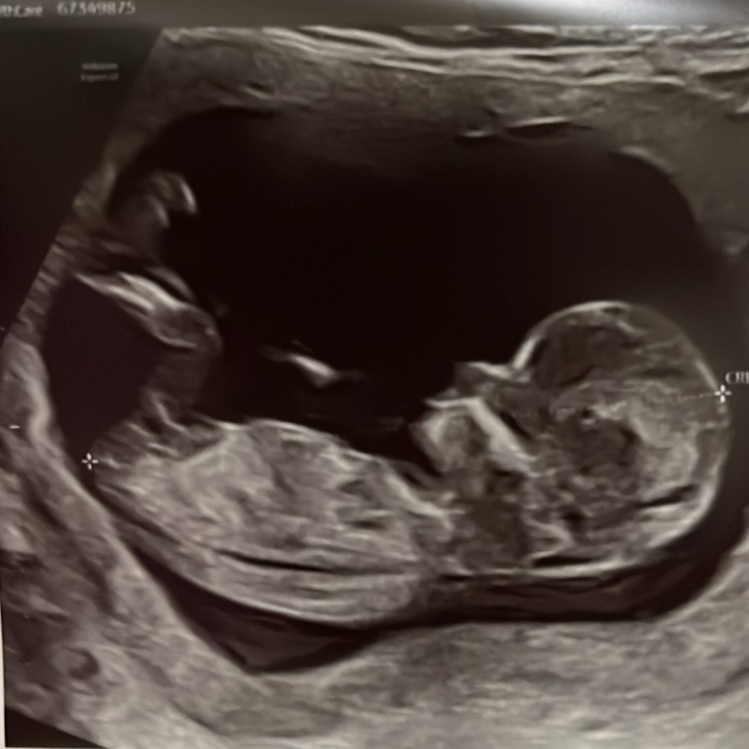 Photo shared by Cristina for their Babylist baby registry.