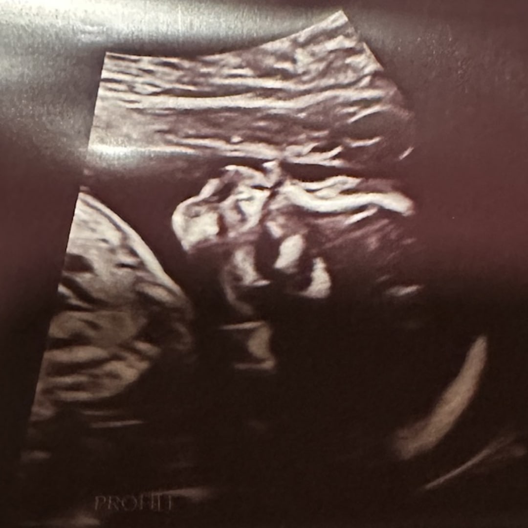 Photo shared by Liliana for their Babylist baby registry.