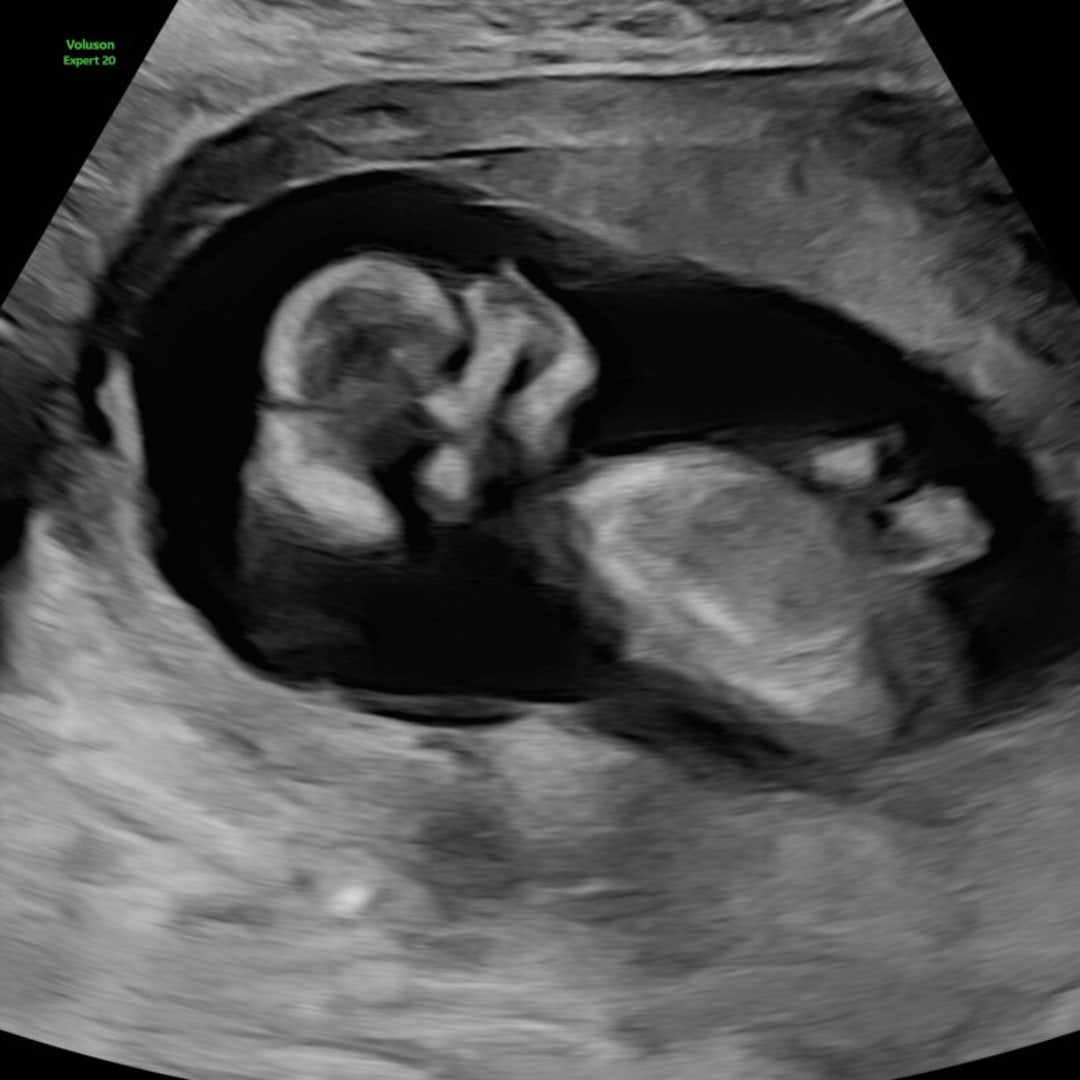 Photo shared by Sally for their Babylist baby registry.