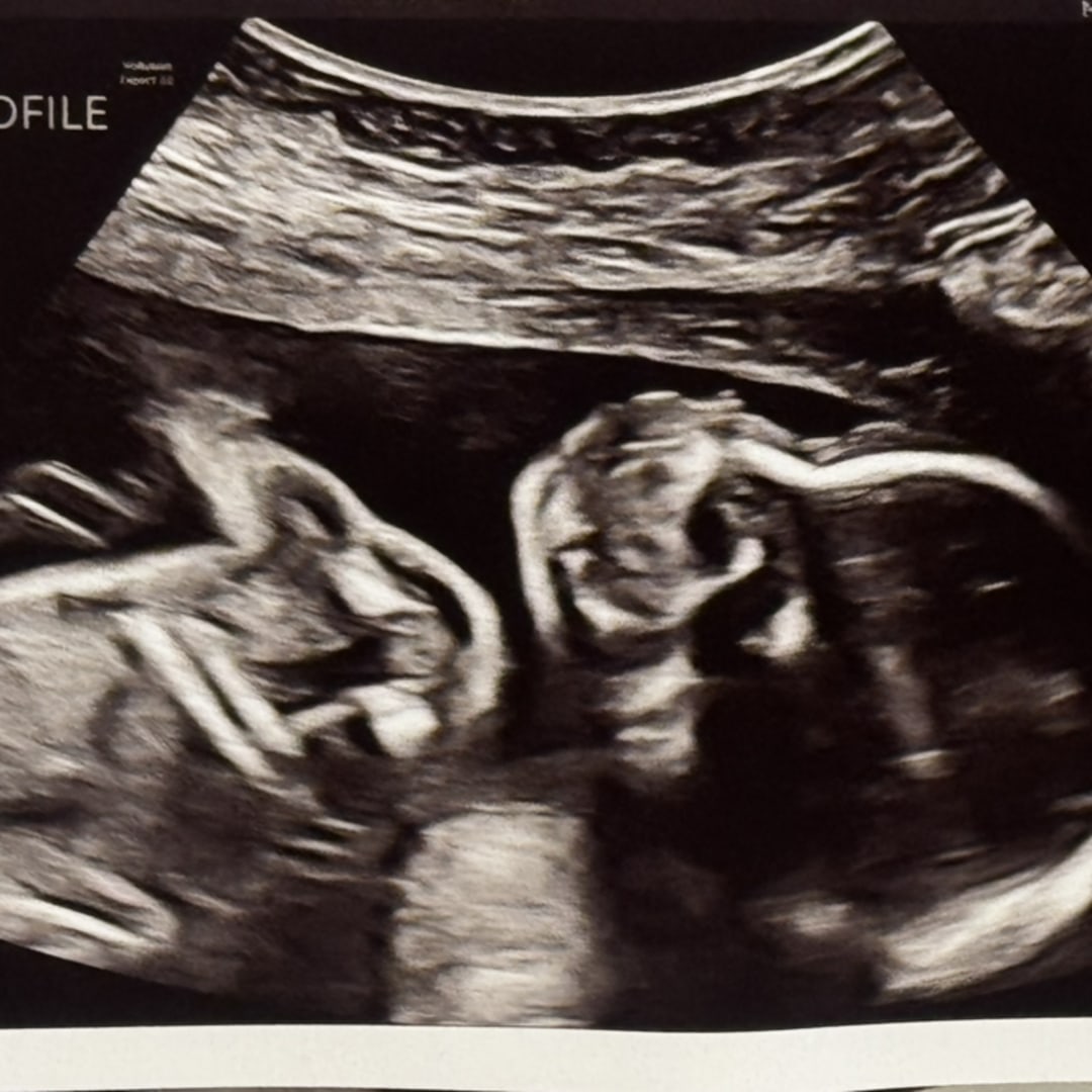 Photo shared by Rachel for their Babylist baby registry.