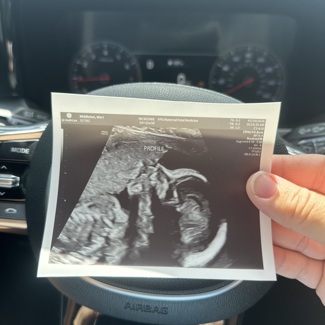 Photo shared by Mia for their Babylist baby registry.