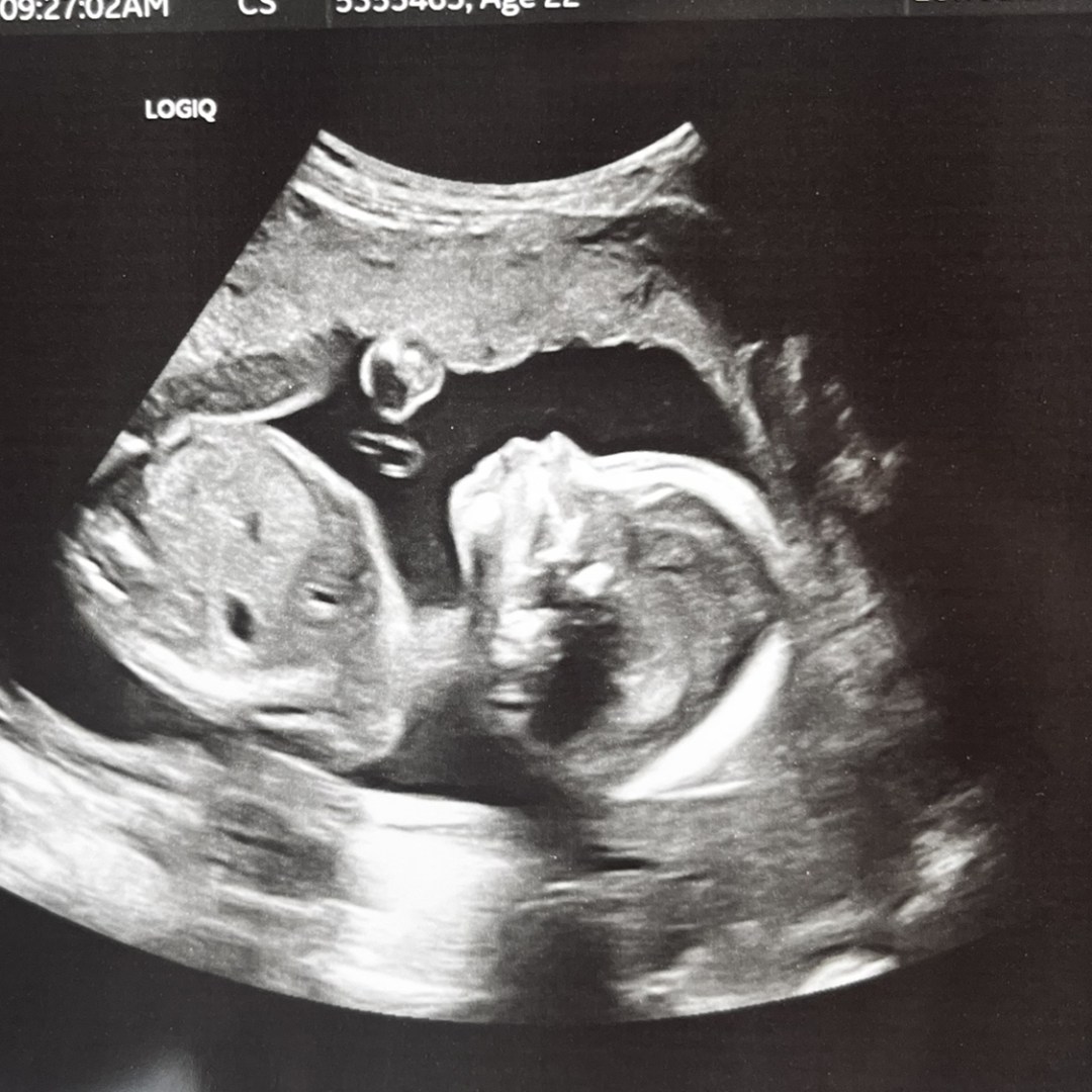 Photo shared by Maicy for their Babylist baby registry.