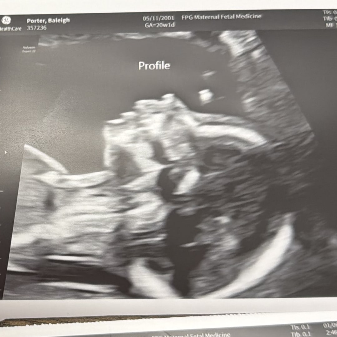 Photo shared by Baleigh for their Babylist baby registry.