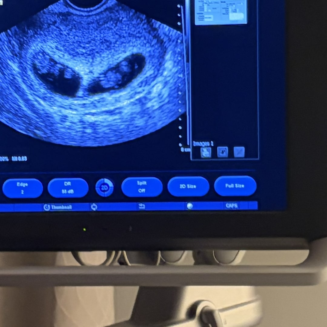 Photo shared by Ryli for their Babylist baby registry.