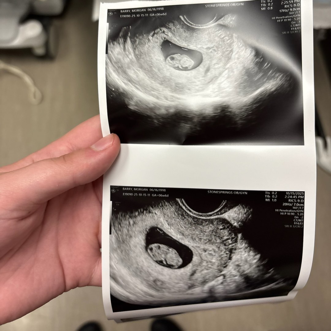 Photo shared by Morgan for their Babylist baby registry.