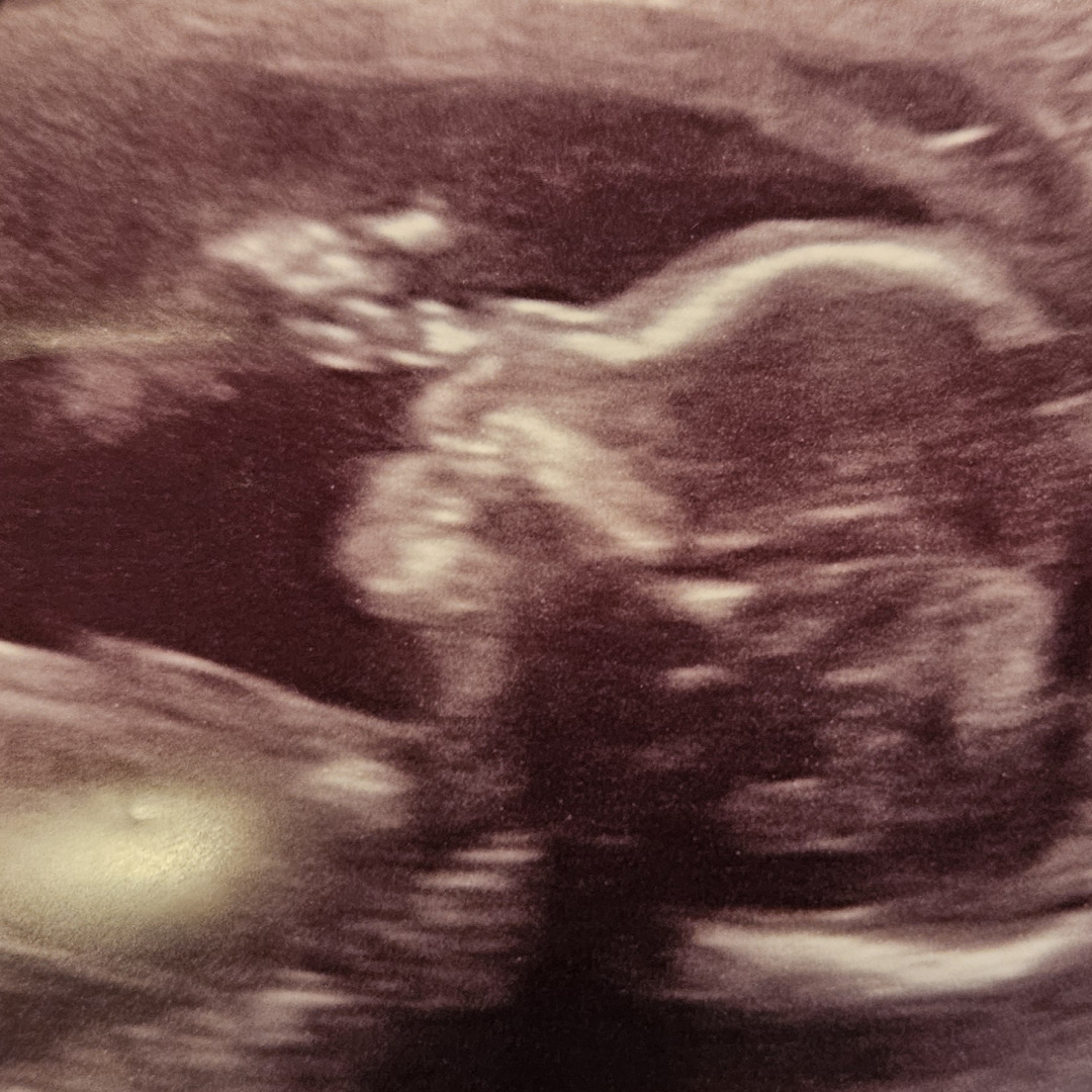 Photo shared by Samantha for their Babylist baby registry.
