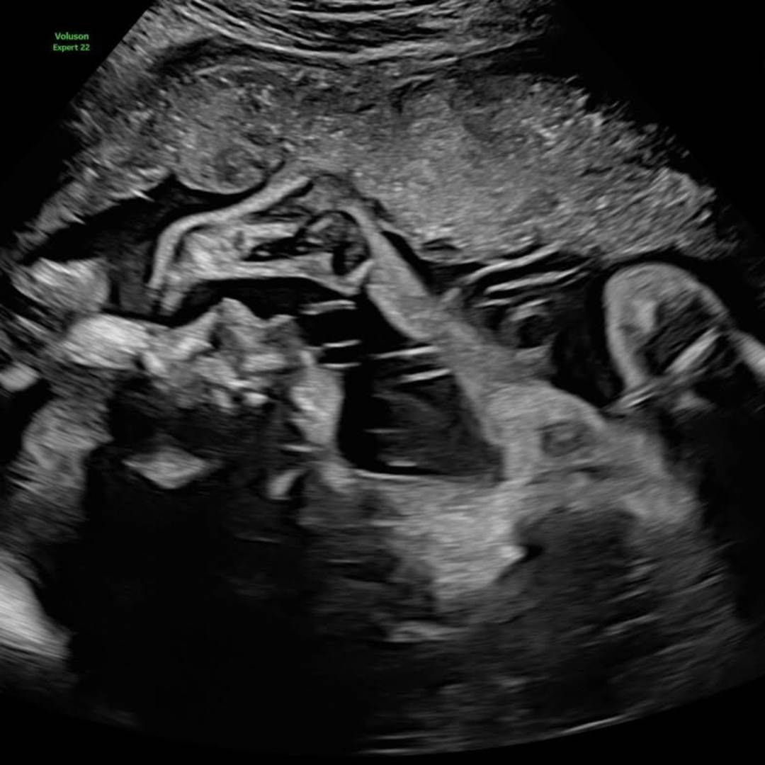 Photo shared by Cecilie for their Babylist baby registry.