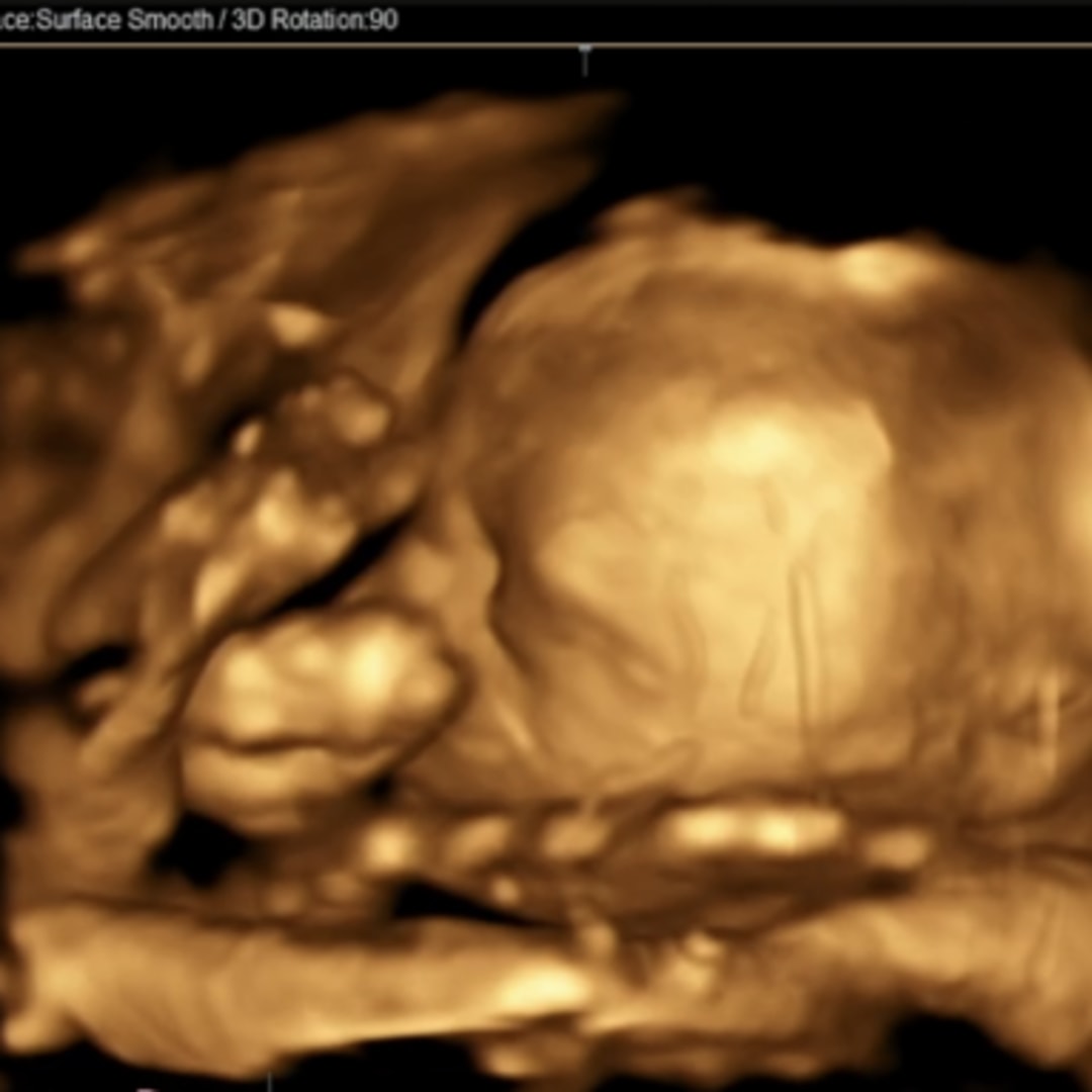 Photo shared by Alexis for their Babylist baby registry.