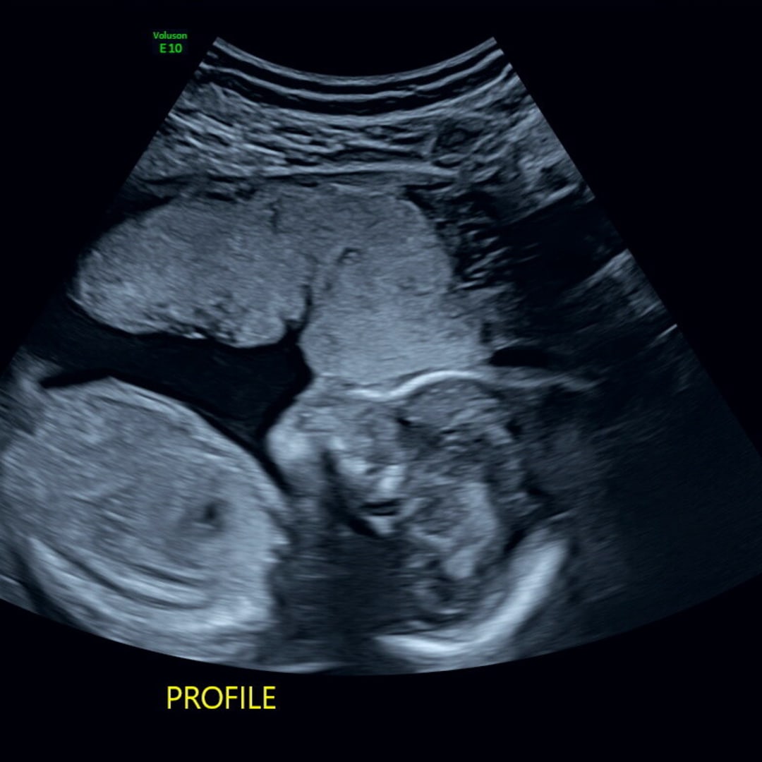 Photo shared by Katie for their Babylist baby registry.