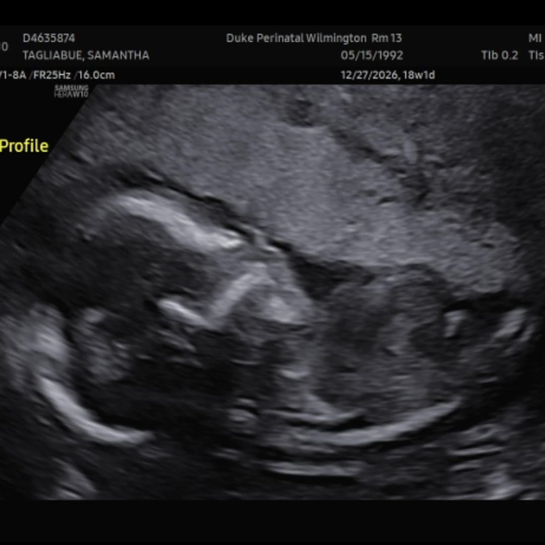 Photo shared by Samantha for their Babylist baby registry.