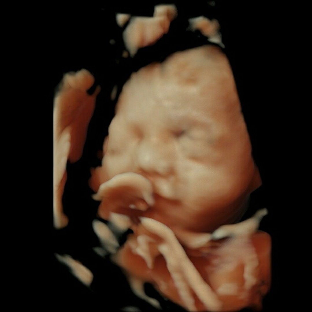 Photo shared by Hannah for their Babylist baby registry.