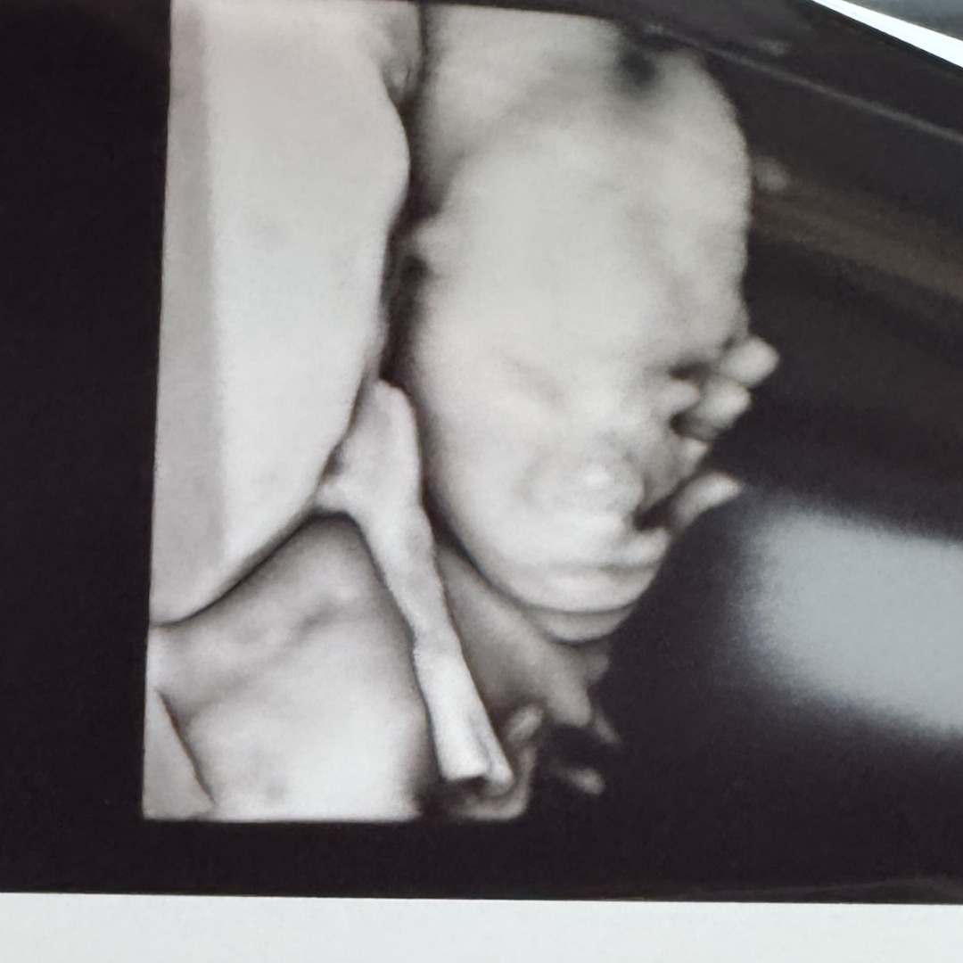 Photo shared by Gracee for their Babylist baby registry.