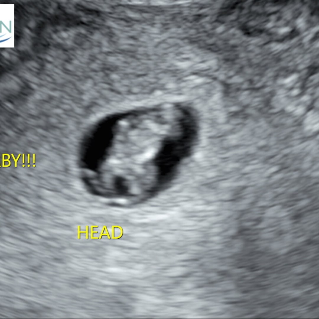 Photo shared by Monica for their Babylist baby registry.