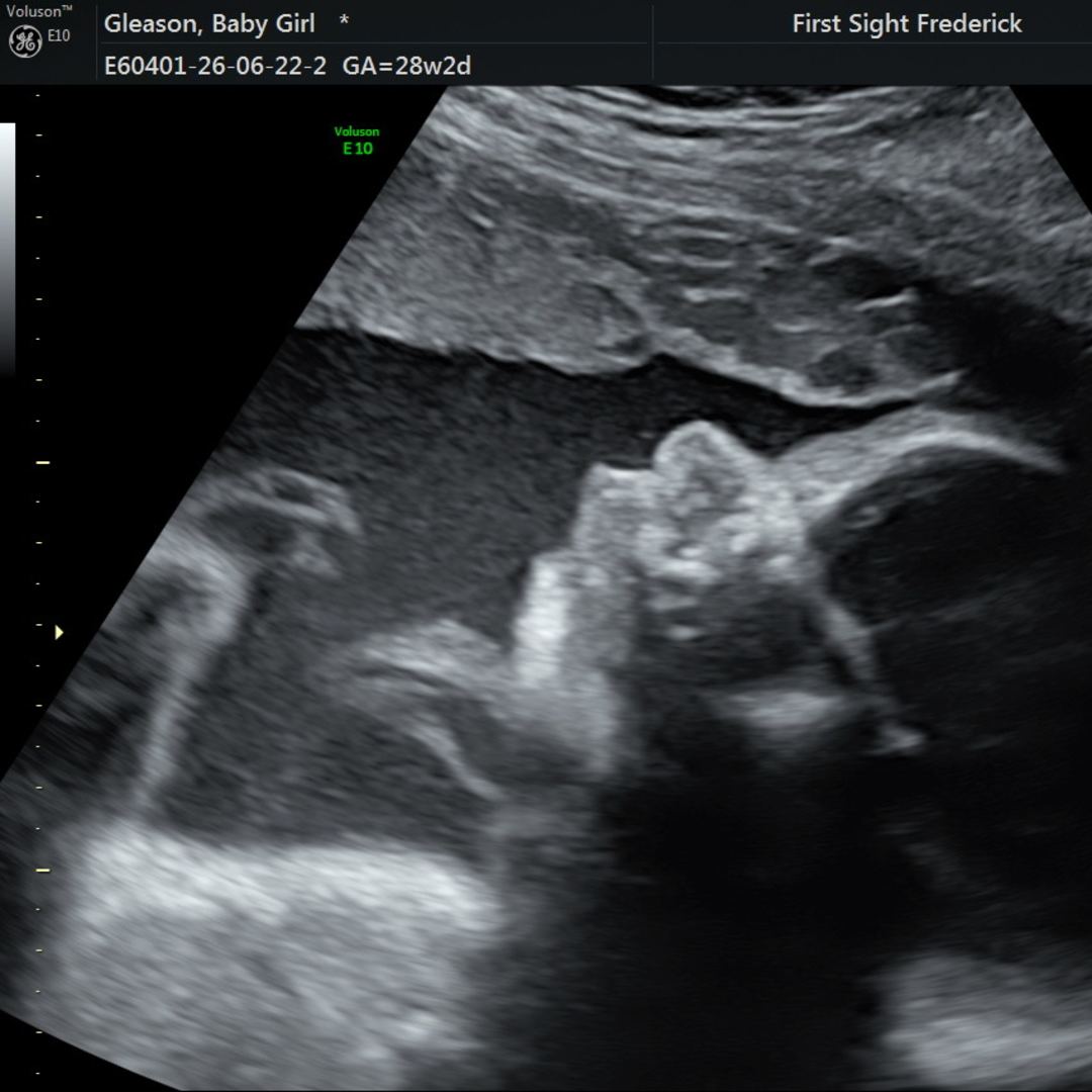 Photo shared by Regan for their Babylist baby registry.