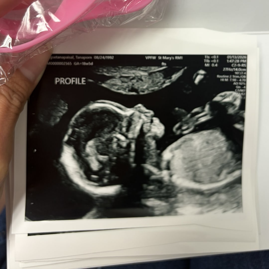 Photo shared by May for their Babylist baby registry.