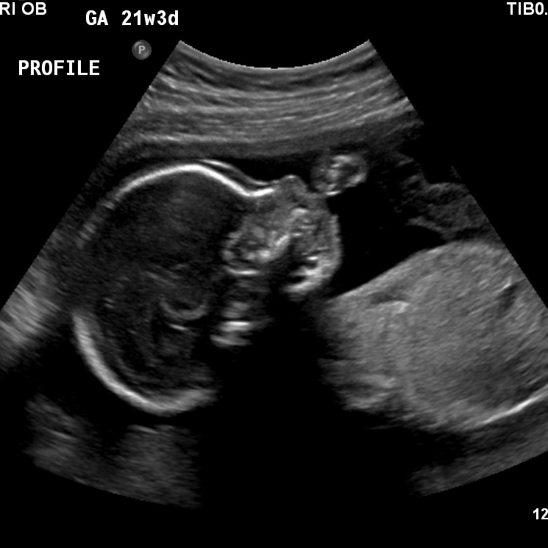 Photo shared by Mahoghany for their Babylist baby registry.