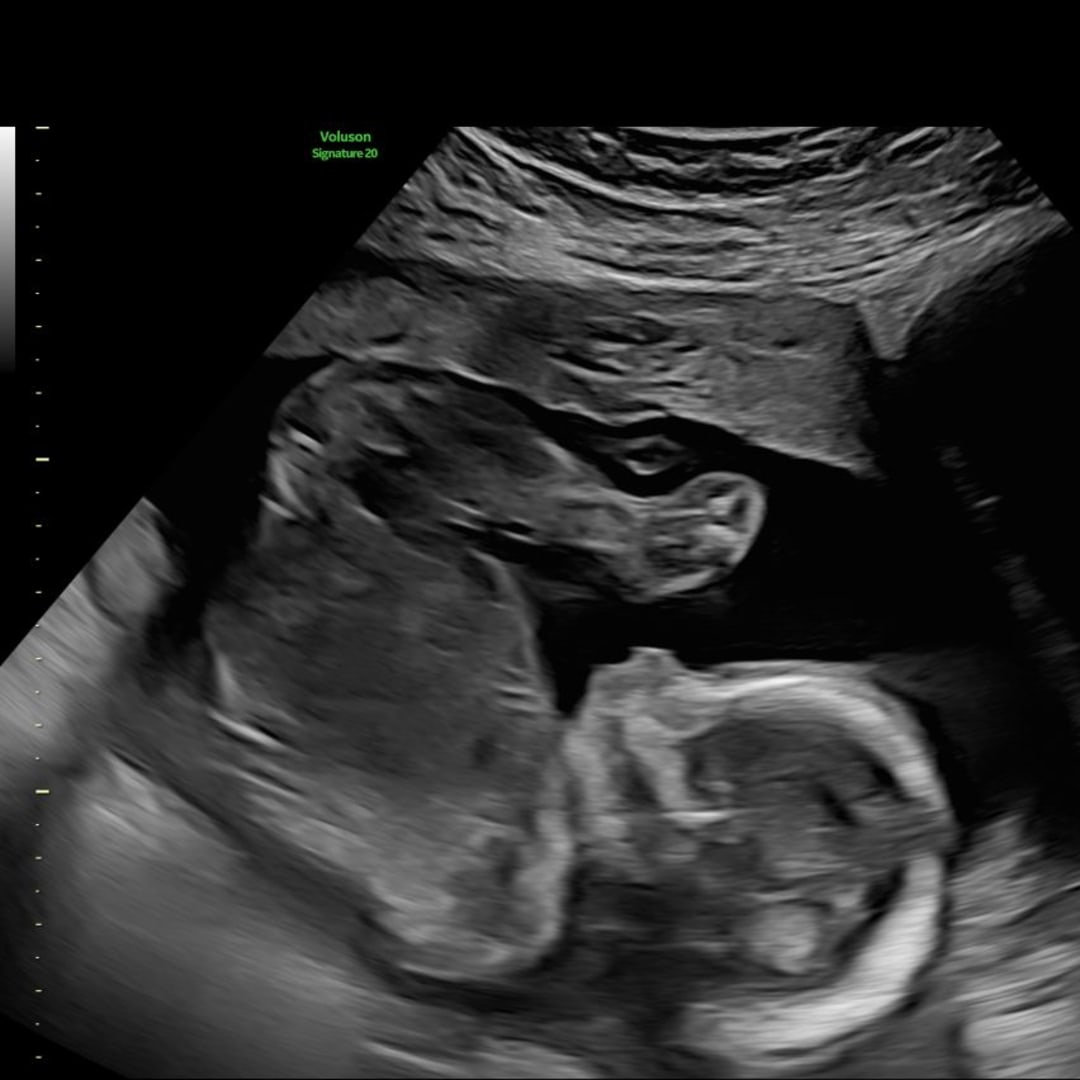 Photo shared by Julia for their Babylist baby registry.