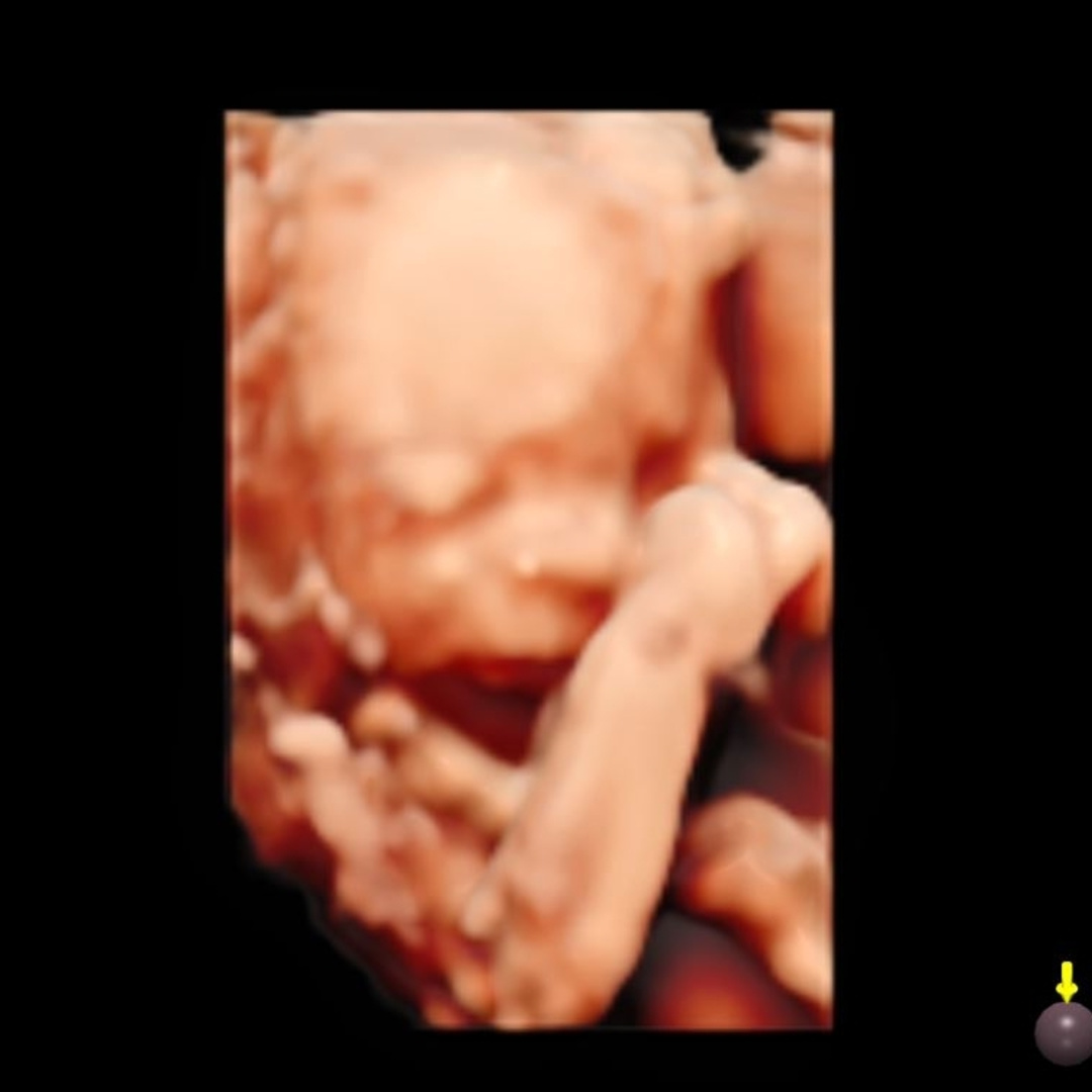 Photo shared by Heilly for their Babylist baby registry.