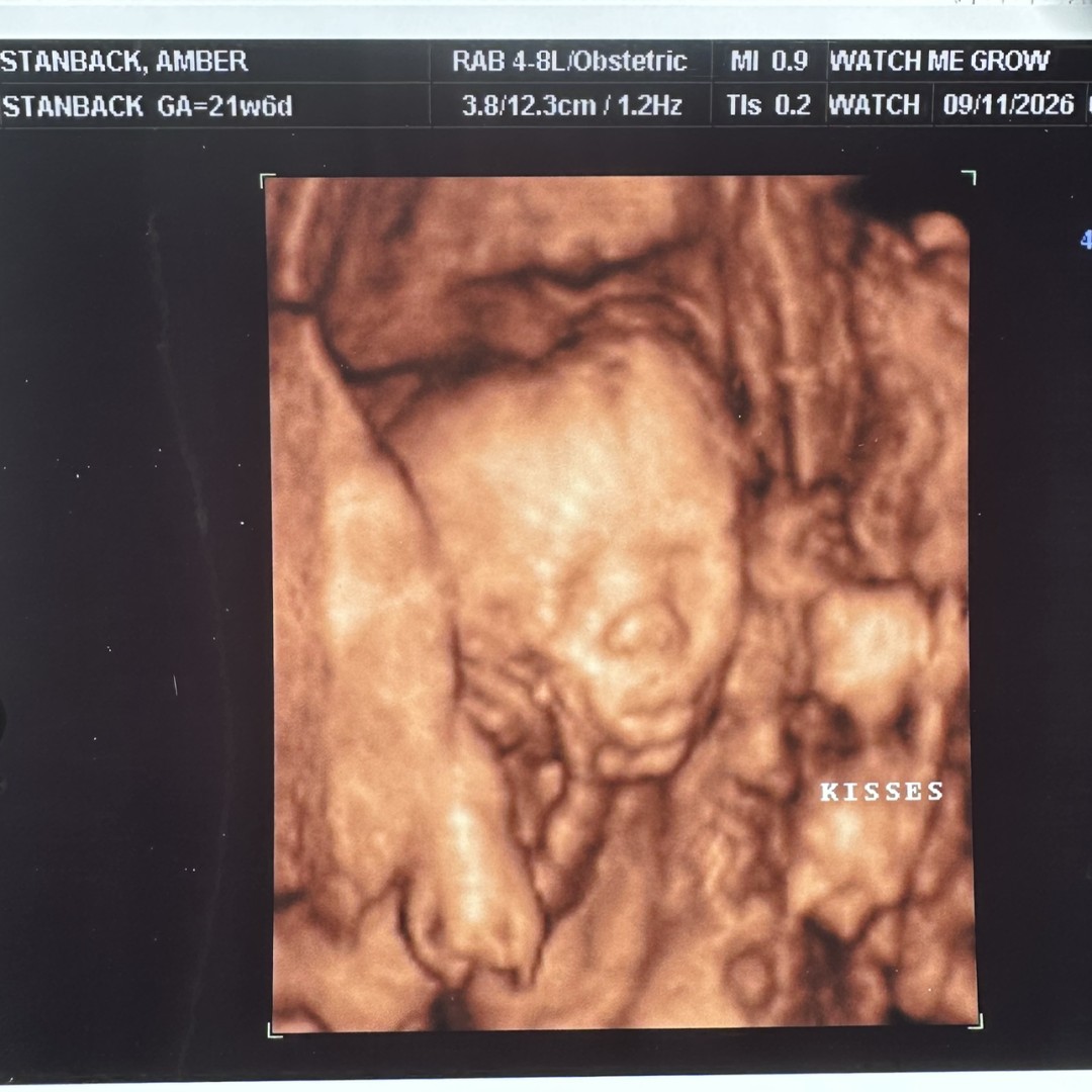 Photo shared by Amber for their Babylist baby registry.